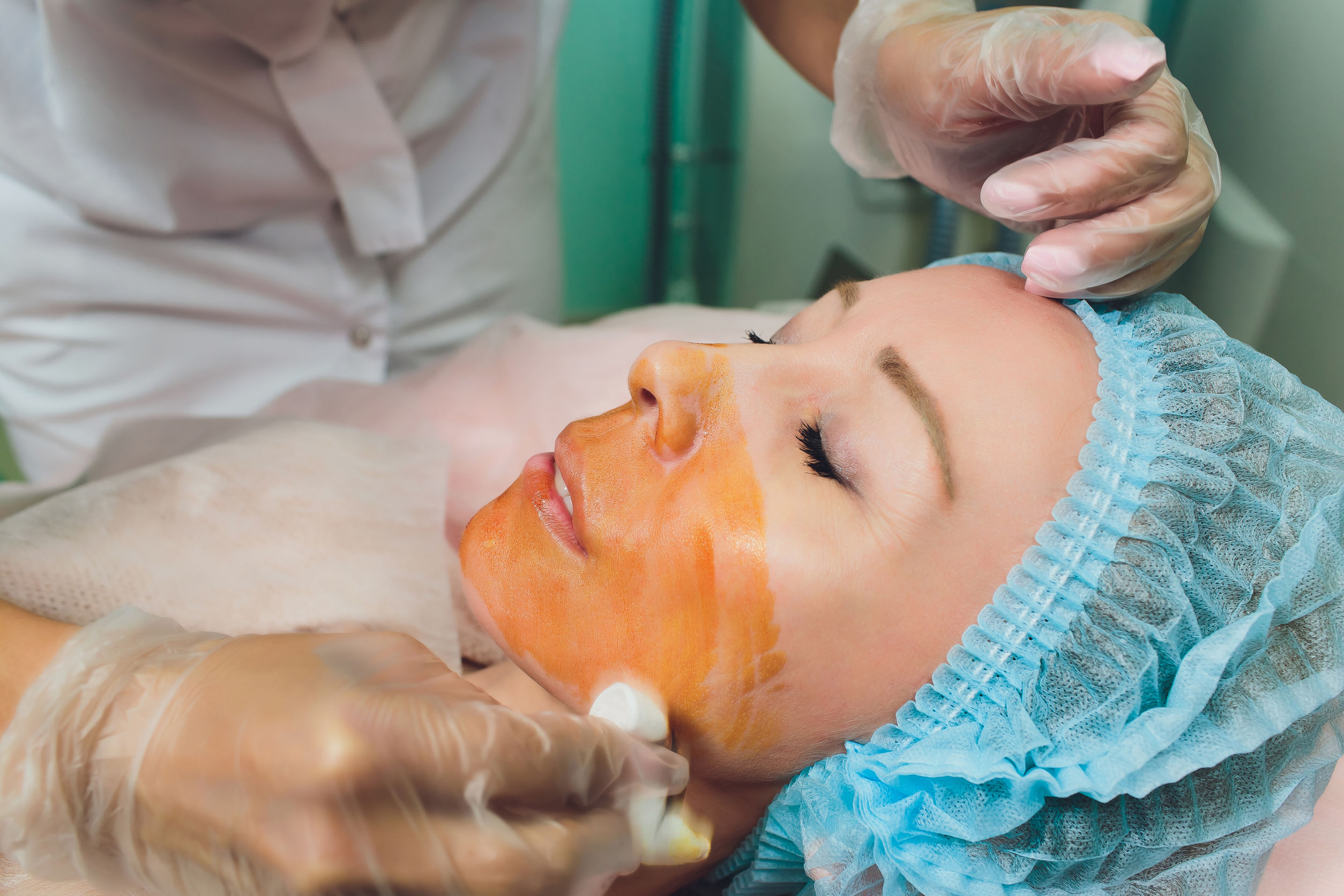 Cosmetic Threading Procedure - Face Lift - 1