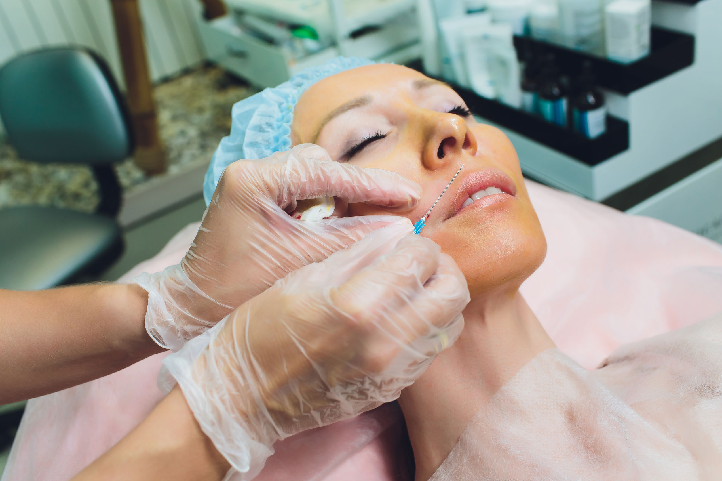 Cosmetic Threading Procedure - Face Lift - 2