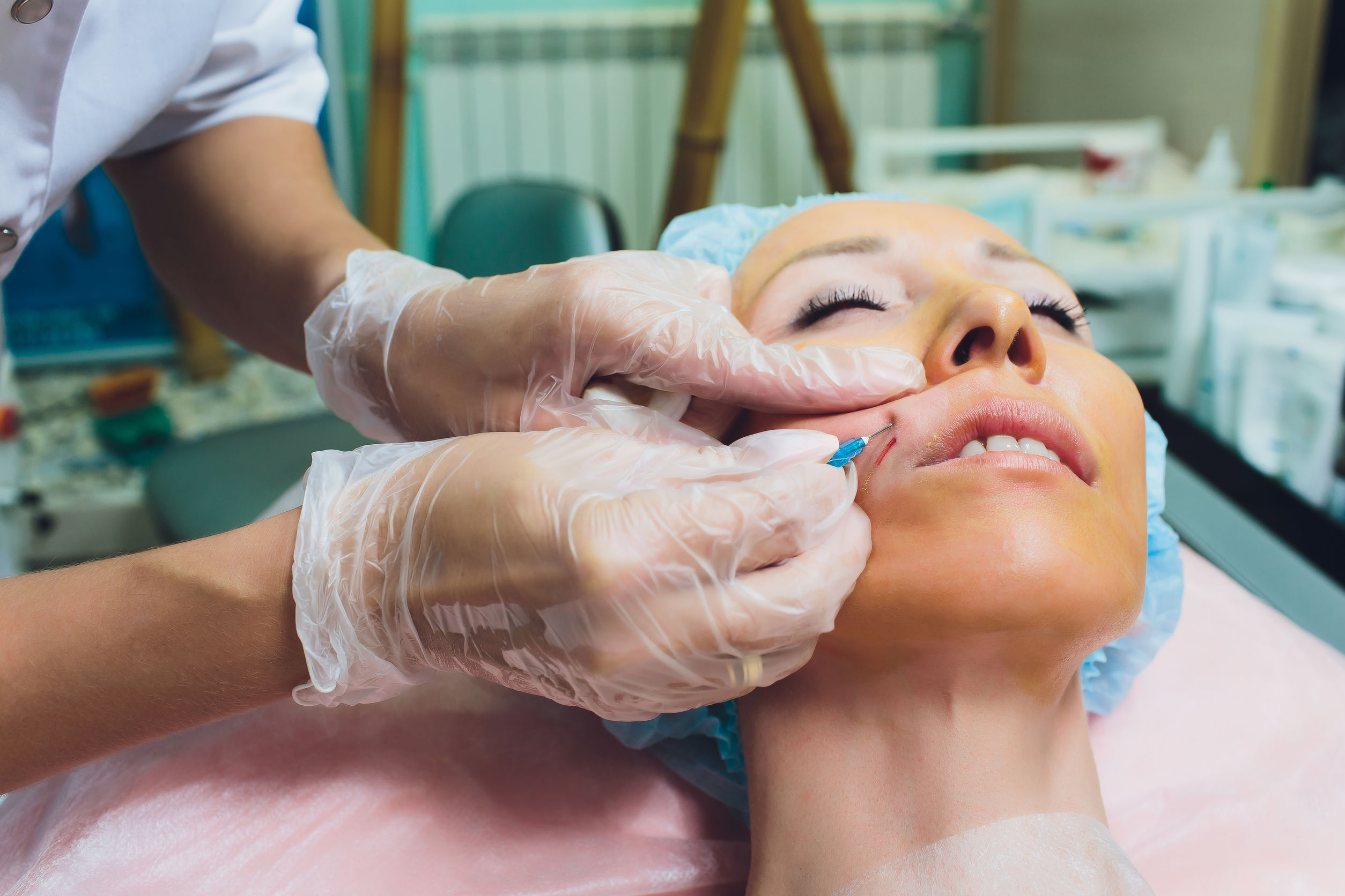 Cosmetic Threading Procedure - Face Lift - 4