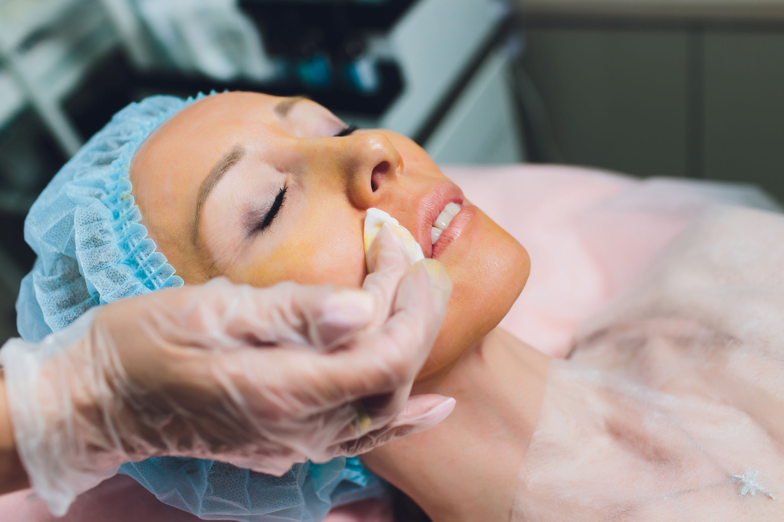 Cosmetic Threading Procedure - Face Lift - 5